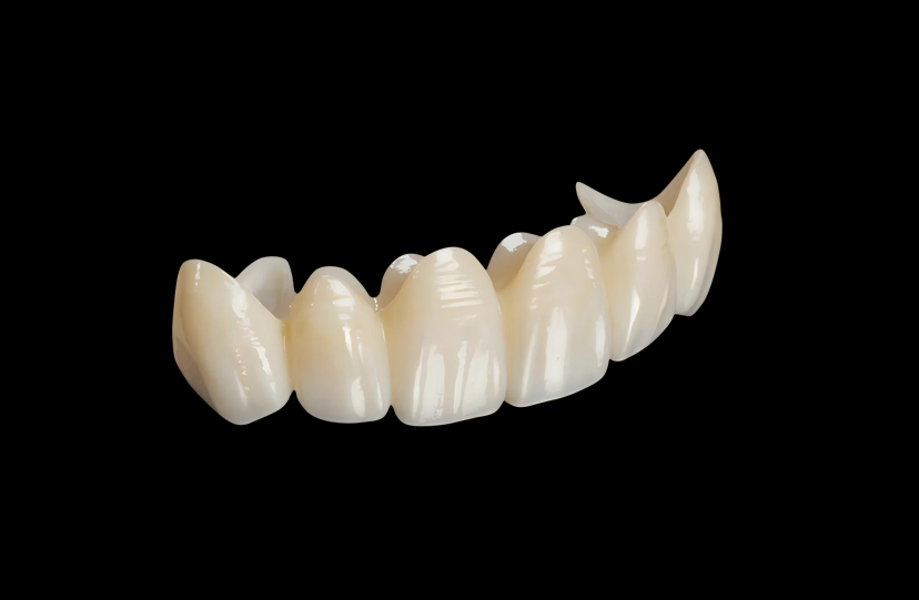 Fully Monolithic Zirconia